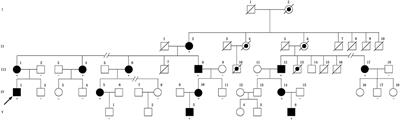 A Novel Variant in Non-coding Region of GJB1 Is Associated With X-Linked Charcot-Marie-Tooth Disease Type 1 and Transient CNS Symptoms